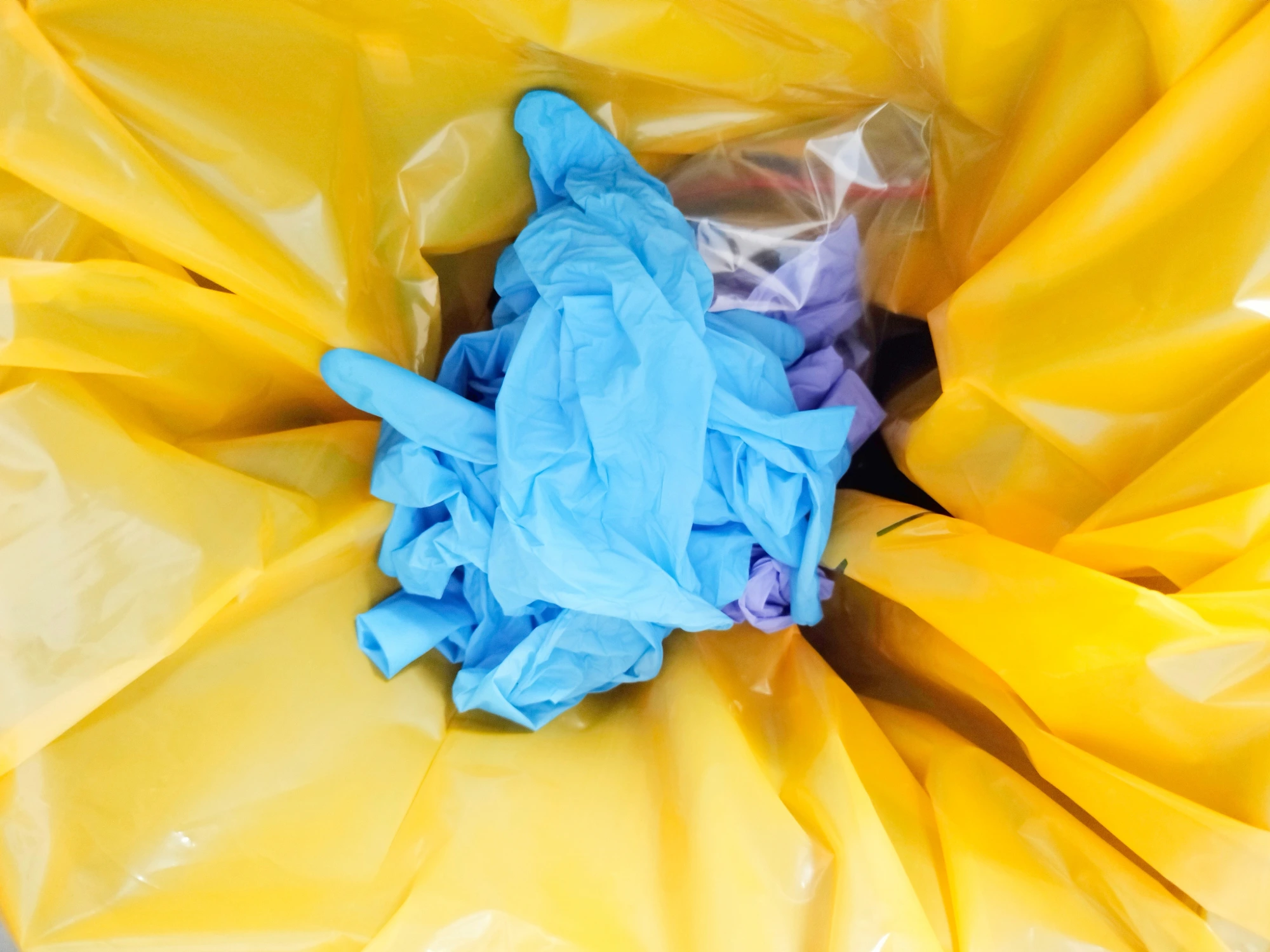 Yellow clinical waste disposal bin with discarded medical gloves.